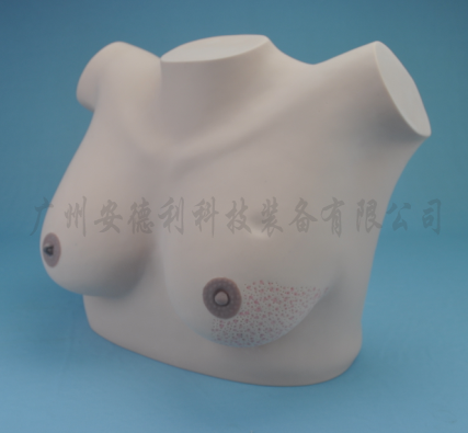 乳腺癌视诊与触诊模型