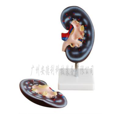 肾解剖模型