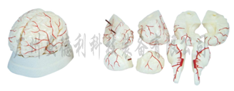 脑动脉模型