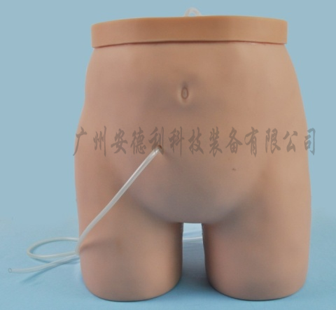 腹膜透析护理模型