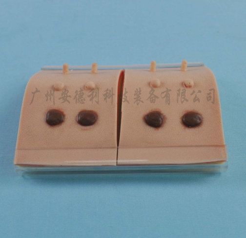 表皮常见病变处理训练模块